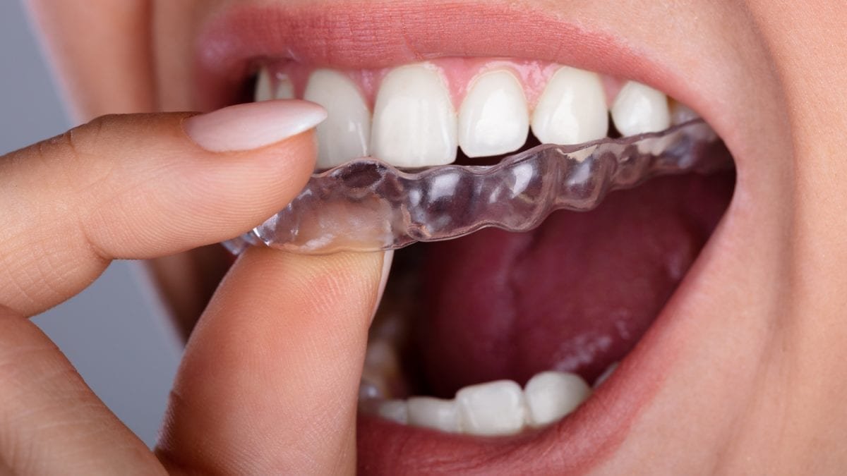 Bruksizm Diş Sıkma ya da Gıcırdatma Diş Eti Doktoru Bloğu